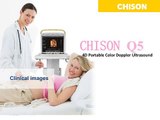 Chison Q5 Clnic Images- most affordable high class color doppler ultrasound