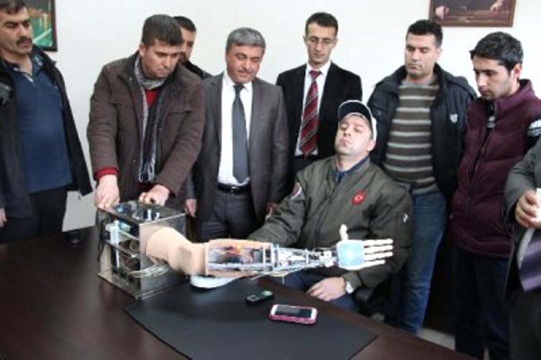 Amasya Üniversitesi'nde Harekete Duyarlı Yapay Kol Yapıldı