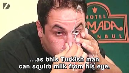 ‪Man Squirts Milk From Eye‬