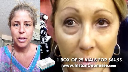 Instantly Ageless Reviews | Instantly Ageless before and after photos