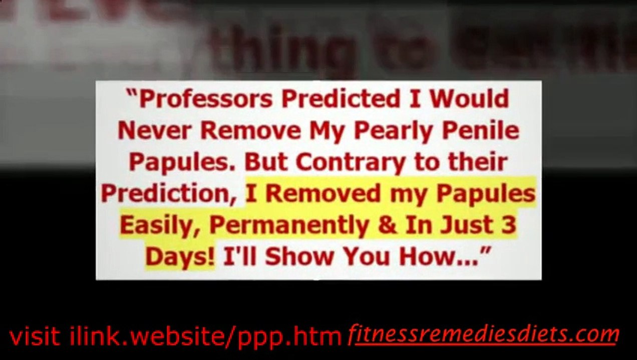 Pearly Papules Penile