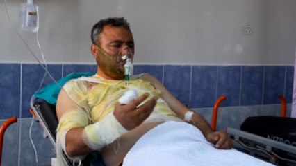 Çakmak Gazı Tüpü Patladı: 1 Yaralı