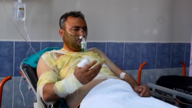 Çakmak Gazı Tüpü Patladı: 1 Yaralı