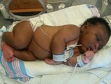 Woman Gives Birth To The Biggest Baby Ever (14.1 Pounds)