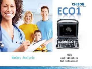 New Model Black white Ultrasound ECO1 By Chison Marketing Analysis V1 0 20141015