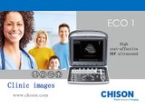 Chison ECO1 portable ultrasound Clinic Images from different organs