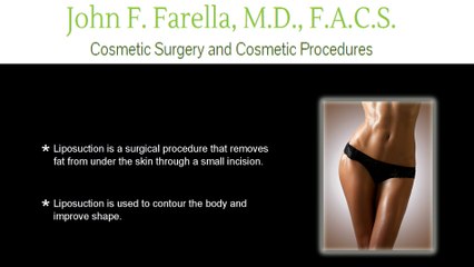 Video: Tips to Achieve the Best Liposuction Results