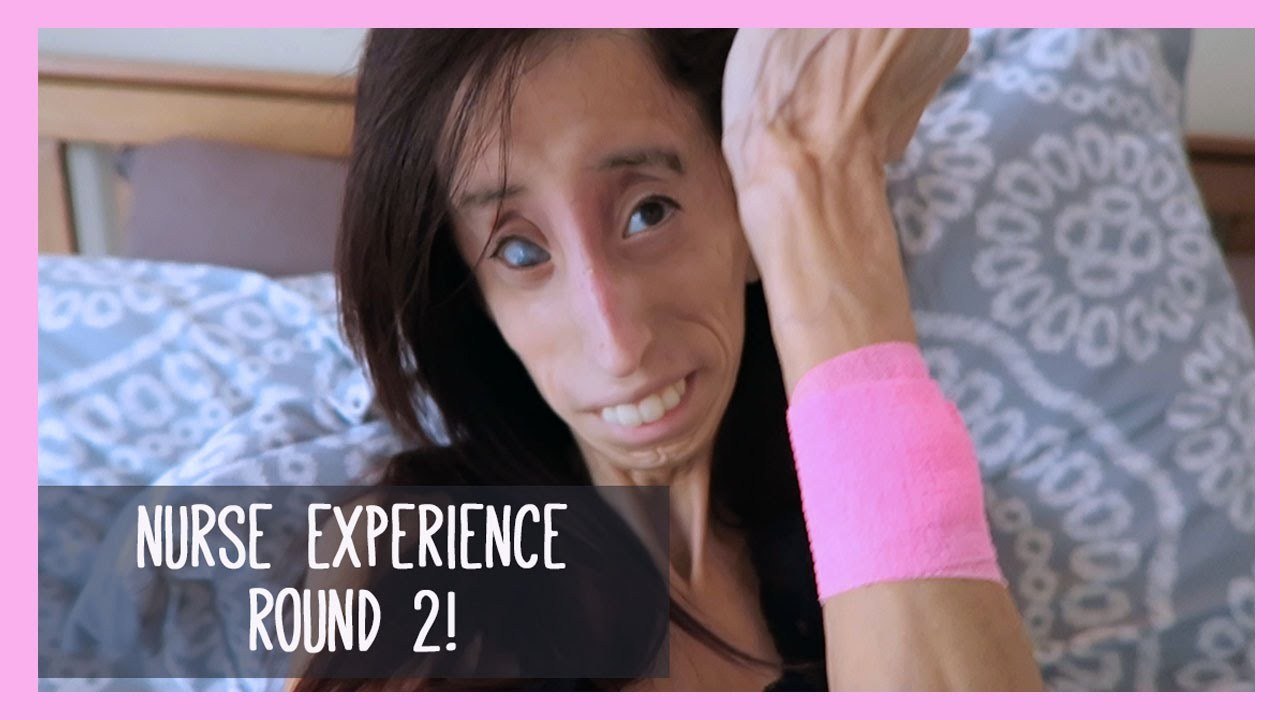 NURSE EXPERIENCE ROUND 2