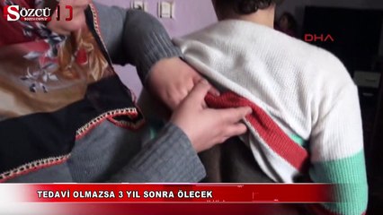Tedavi olmazsa 3 yıl sonra ölecek
