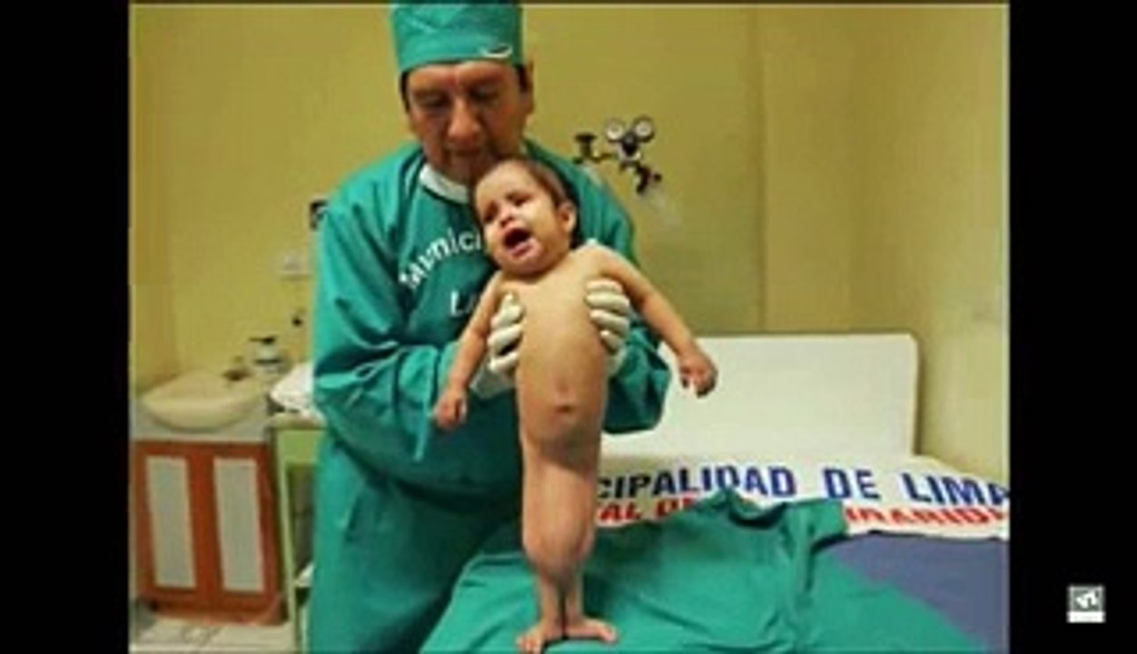 Baby Born as Little Mermaid  Recieves a Miracle - Video Dailymotion