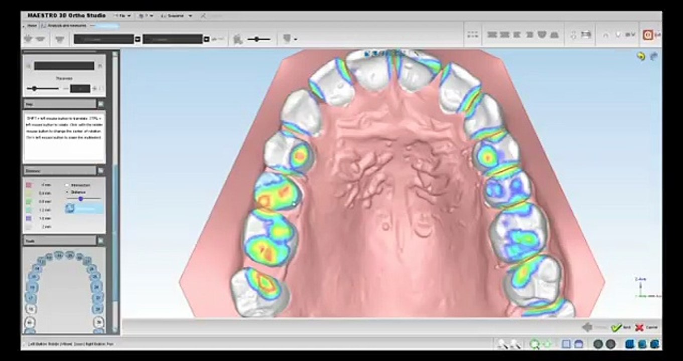 Use 3D Ortho