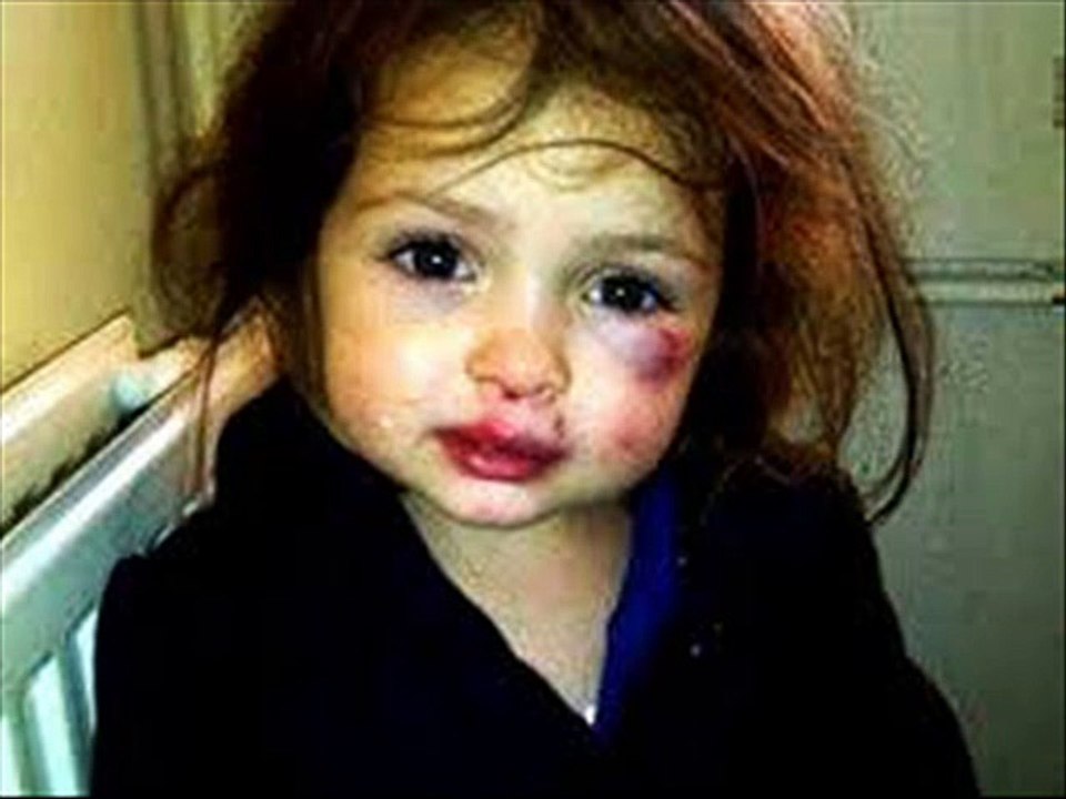 enfant battue