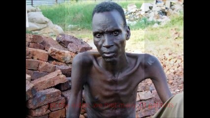 Need for New Drugs in TB  Scientific Challenges for Cure