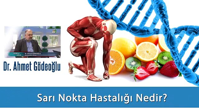 Sarı Nokta Hastalığı Nedir?