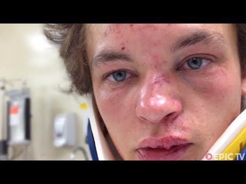 MTB Head Injury at Redbull Joyride, Recovery | Brayden Barrett-Hay: reGAINING PSYCHE, Ep. 1