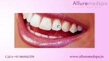 Tooth Jewellry Treatment in Andheri