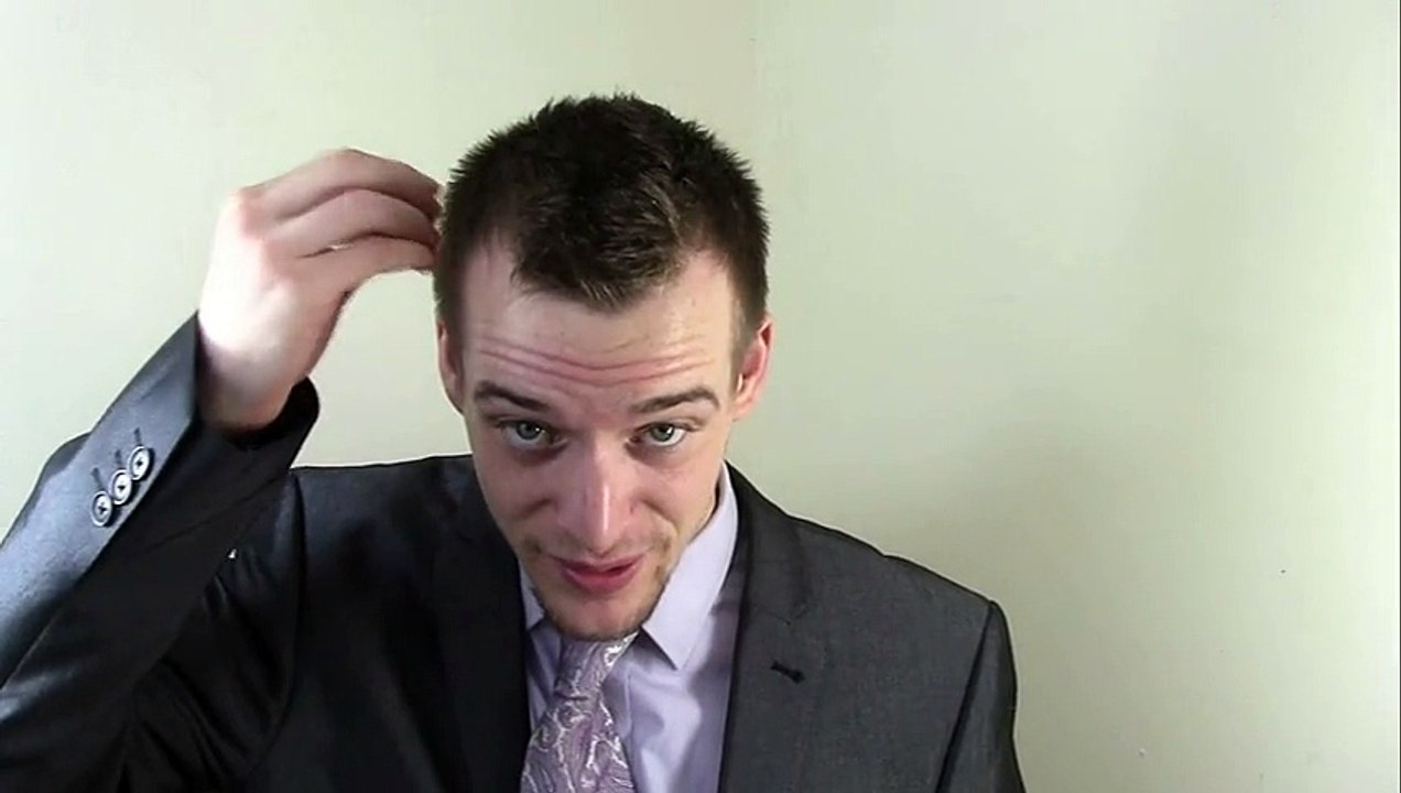 The Science of Hair Loss / Balding