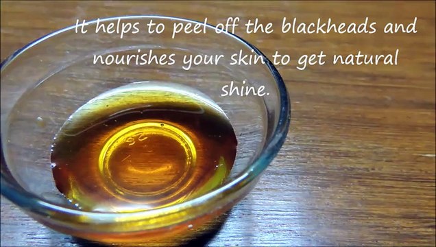 How to get rid of blackheads naturally effective & fast I Best DIY instant blackhead remover I Home remedies