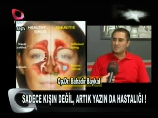 Sinüzit Belirtileri ve Tedavisi