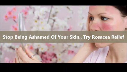 Skinception Rosacea Relief Serum Reviews