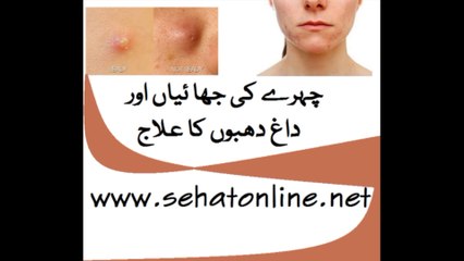 Pimples Removal Tips in Urdu
