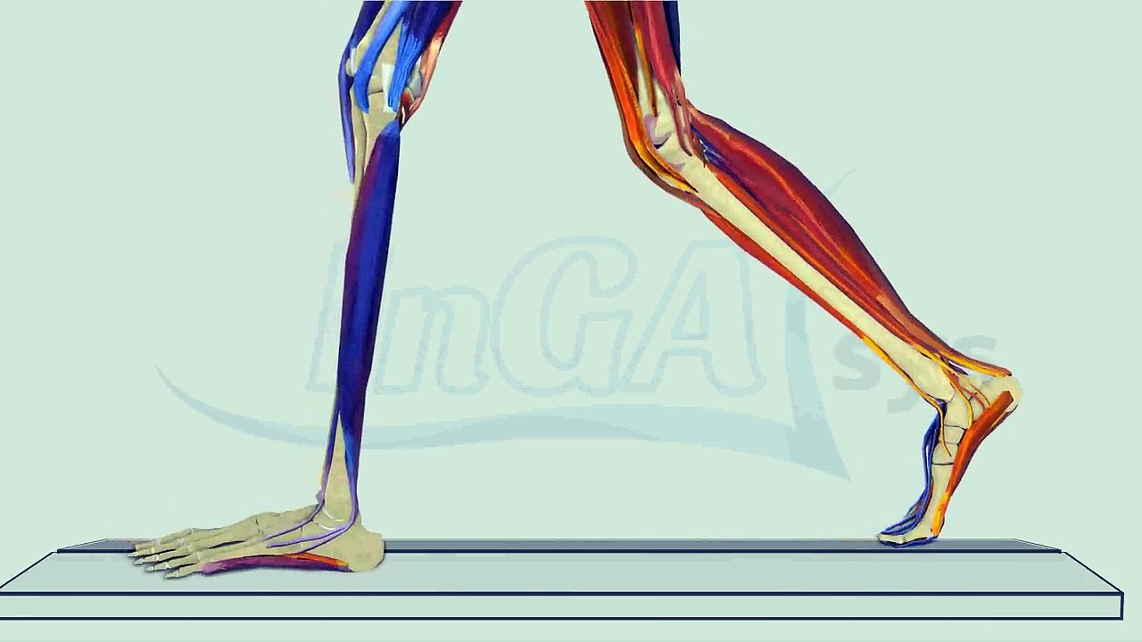 Schmerzen im Wadenbereich - InGAsys - Intelligente Ganganalyse Software