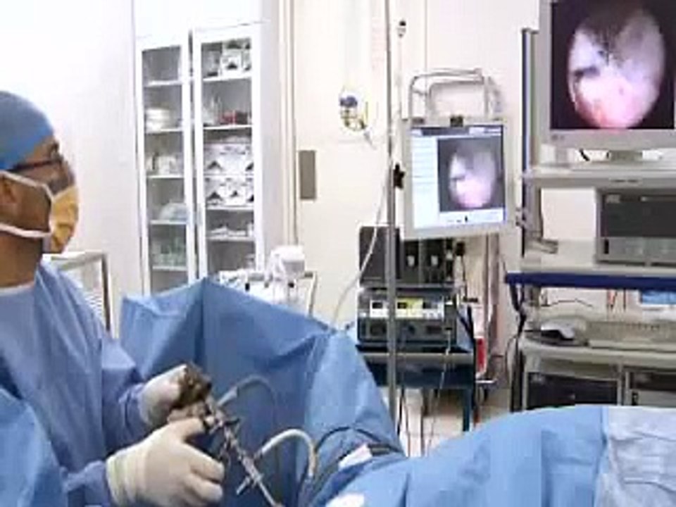 TURP Prostate Operation Australia
