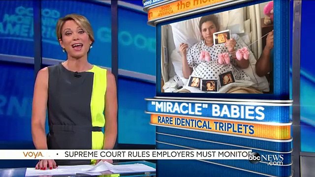 Conjoined Twins Born from Set of Identical Triplets