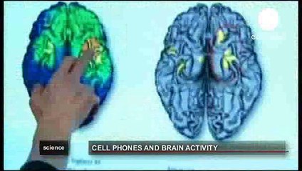 Cep telefonları beyni nasıl etkiliyor?