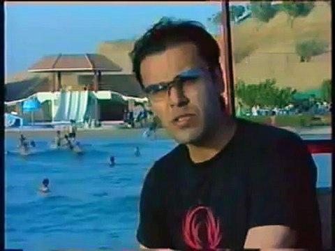 'Kunwar Nafees' 'Results 'Hair Transplant' 'Dr. Zulfiqar H. Tunio'
