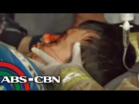 2 hurt in AUV-bus collision along EDSA-Guadalupe