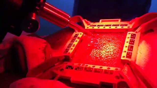 Greffe capillaire technologie ARTAS par The Clinic Paris