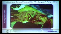 Acute and Chronic Pancreatitis | O. Joe Hines, MD | UCLA Digestive Diseases