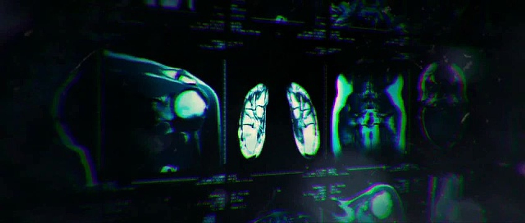 Vice Official Trailer 1 (2015) - Bruce Willis Action Movie HD