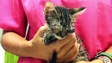 Rania is going to lose her eyes, but she shouldn´t lose her life