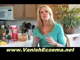 Natural Remedies For Eczema - Tips on How to Beat Eczema the Natural Way