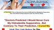 Don't Buy Fast Hidradenitis Suppurativa Cure Fast Hidradenitis Suppurativa Cure Review Bonus + Disco