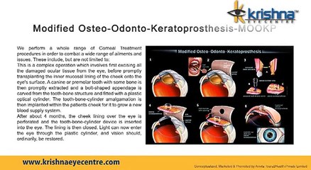 Modified Osteo-Odonto Keratoprosthesis Mumbai | Corneal Treatment Procedures Parel