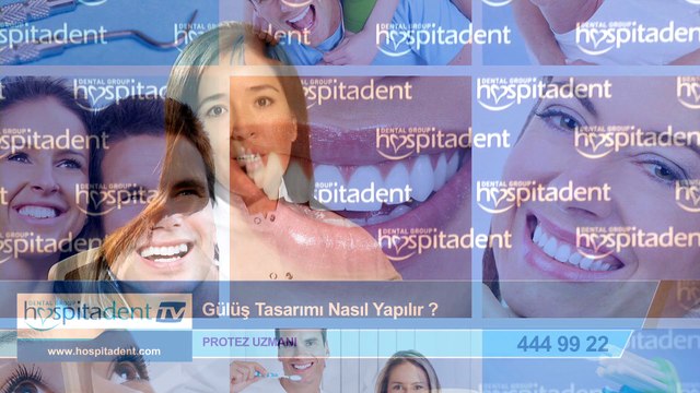 Gülüş Tasarımı Nasıl Yapılır?