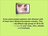 Home Remedies To Get Rid Of Rosacea - how to get rid of rosacea on face