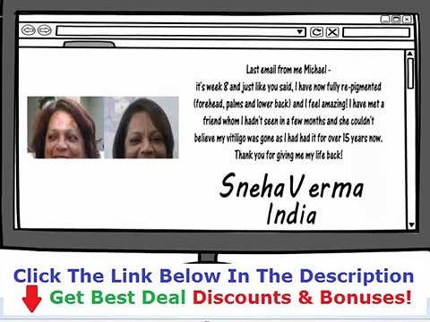 Natural Vitiligo Treatment System By Michael Dawson Reviews Discount + Bouns