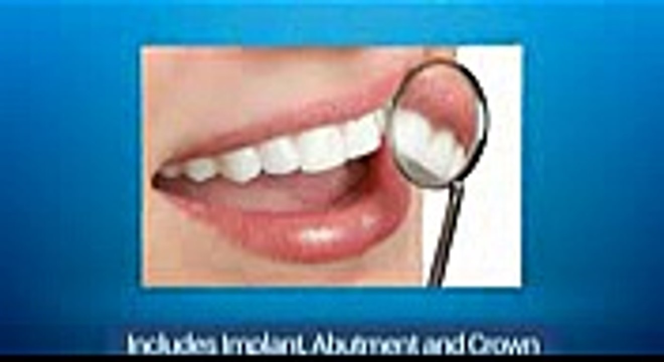 Dental Implant Dentistry Seattle