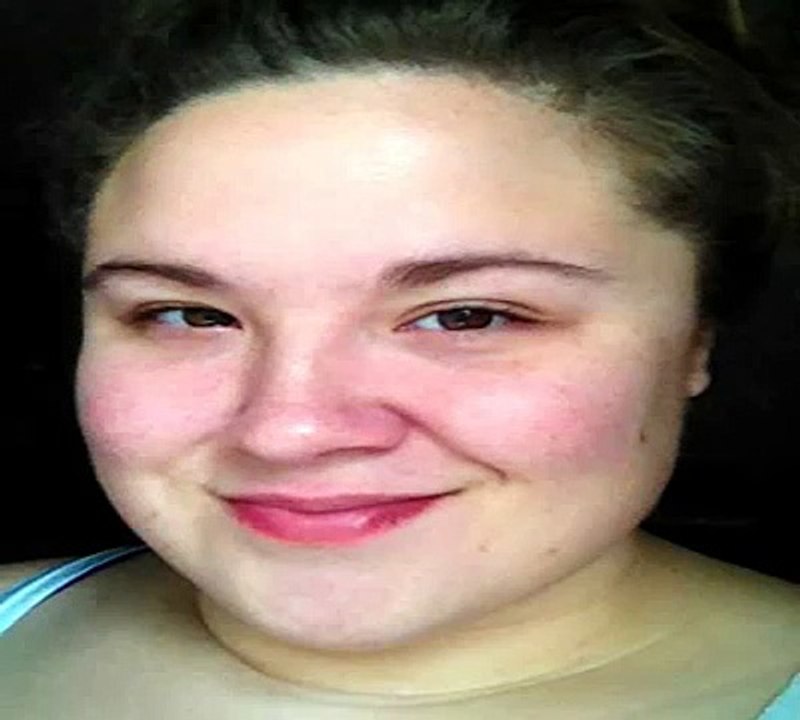rosacea makeup