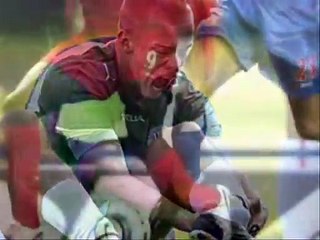 Worst Sport Injuries Ever...