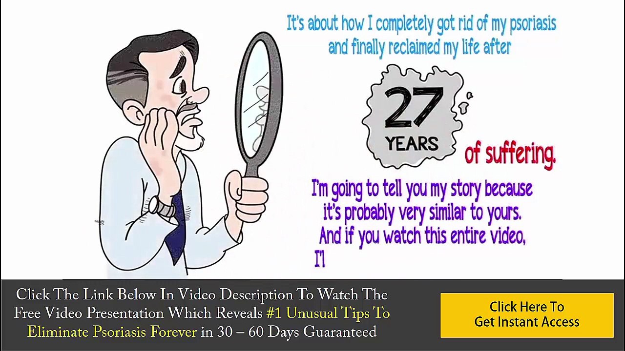 Natural Remedies For Psoriasis Best Natural Treatment And Cures For Psoriasis