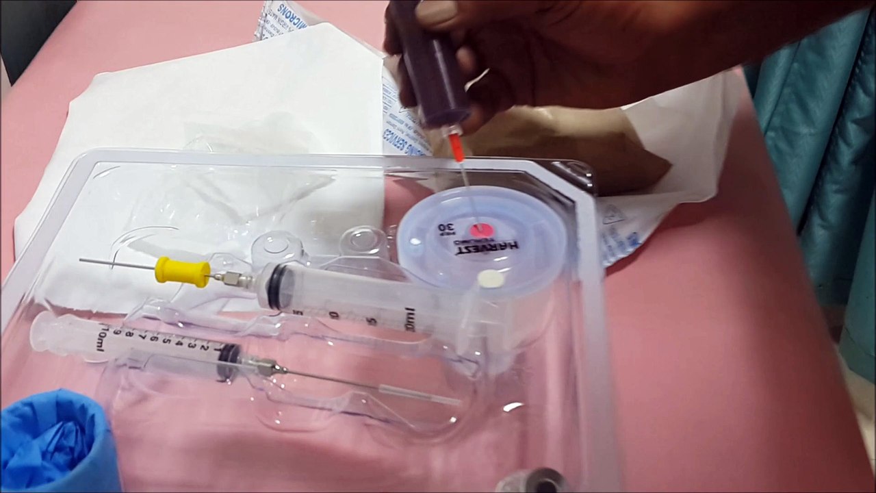 PRP injection Chennai