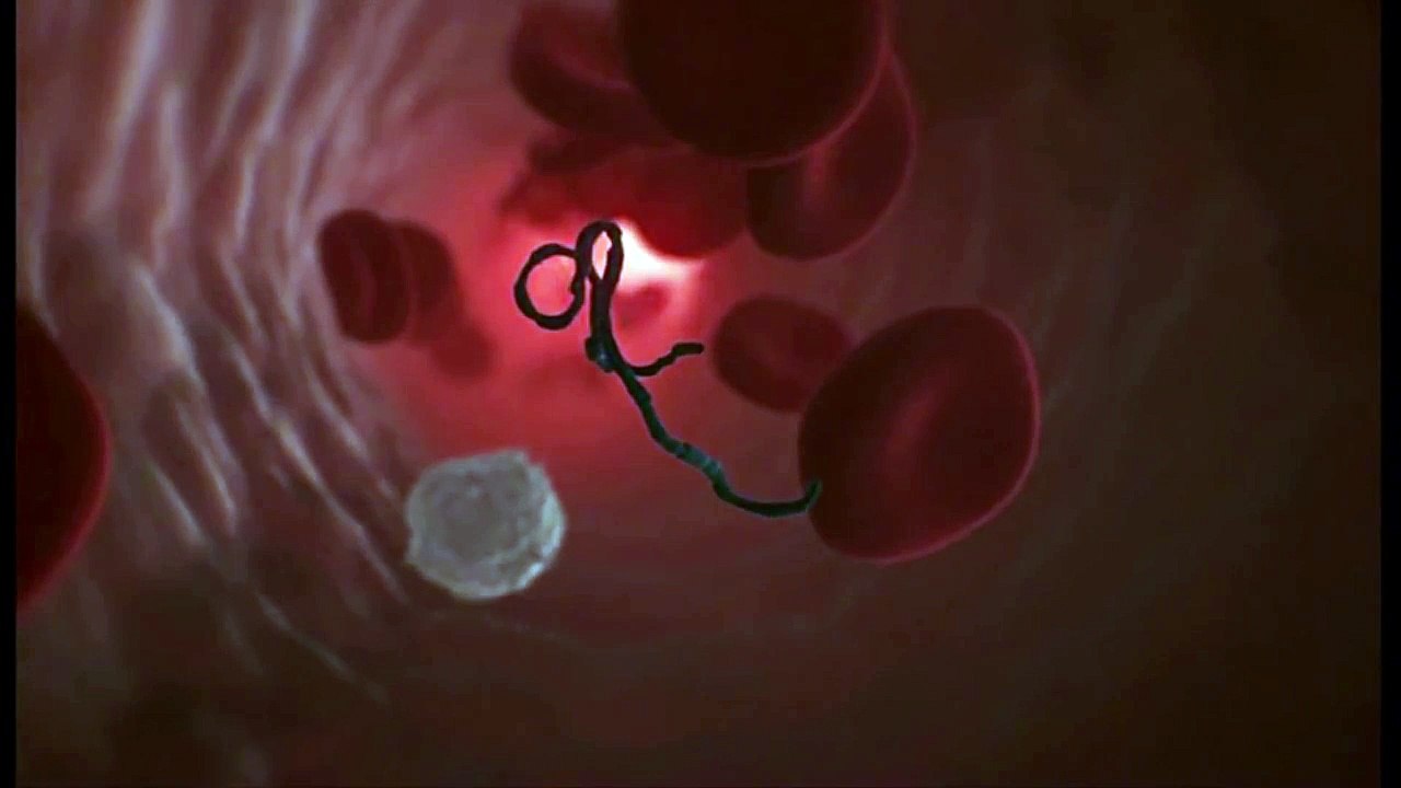 How does Ebola attack human cells_ BBC News