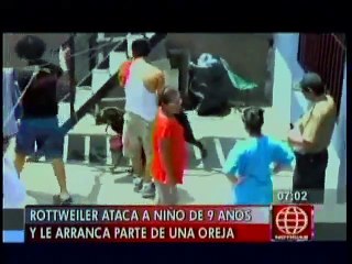 Santa Anita: Rottweiler le arrancó parte de oreja a niño de 9 años