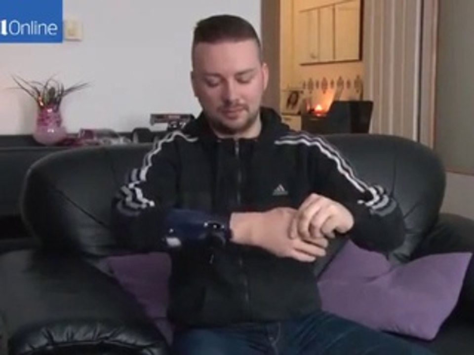 Bionic hand controlled by the mind