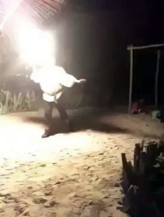 Fire Spitting Gone Wrong!